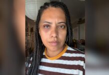 Carla Lemos é vítima de agressão em samba no Rio: “Não dirigi uma palavra a ele; eu era a menor, a mais fraca” Retrato da Carla Lemos com o rosto machucado após agressão