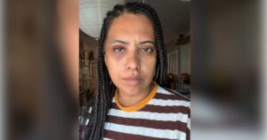Retrato da Carla Lemos com o rosto machucado após agressão